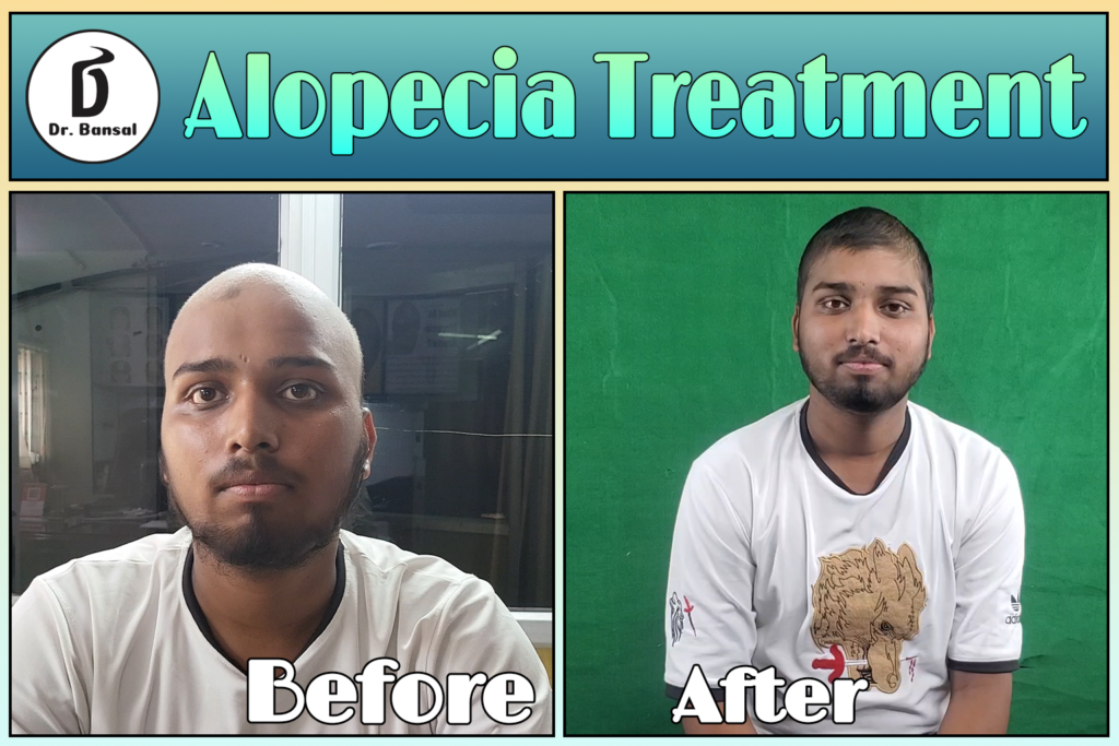 Top Hair Loss Treatment Doctor