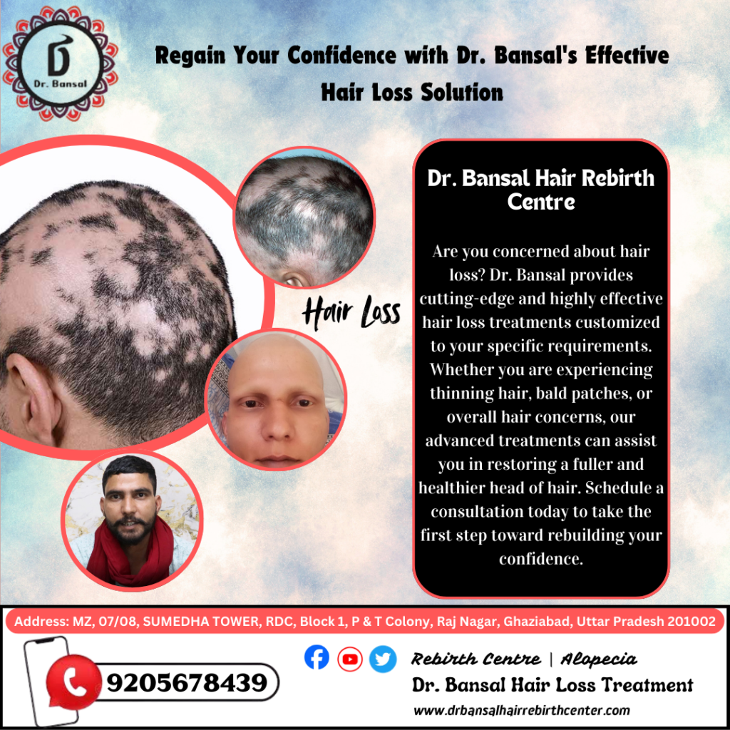 The Best hair loss clinic in Ghaziabad