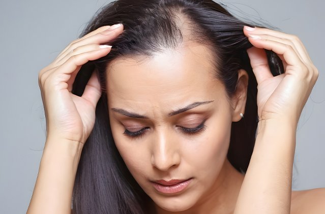 Best Ayurvedic Treatments for Hair Loss in Ghaziabad