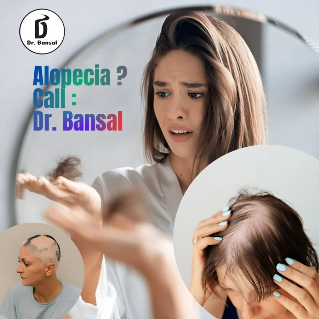 Alopecia women