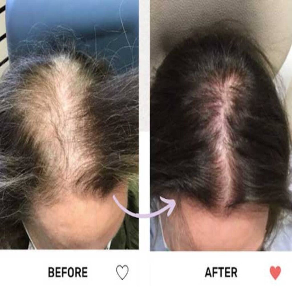 Top Alopecia Doctors in Ghaziabad