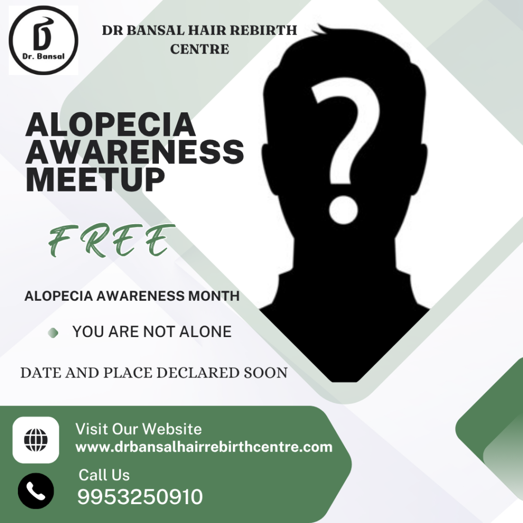 ALOPECIA FREE MEETUP